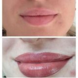 Micro Labial