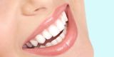 clareamentodental