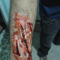 Maquiagem de efeito(cortes e feridas)