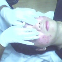 DRENAGE LINFATICA FACIAL